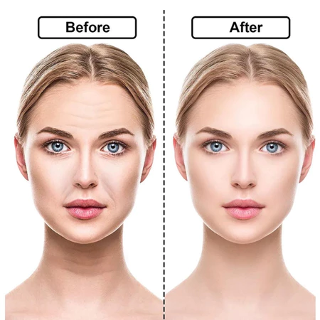 16pcs Adesivo de Silicone Renew