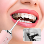 🦷AquaSmile Pro™ – Irrigador Bucal Portátil Recarregável 💧